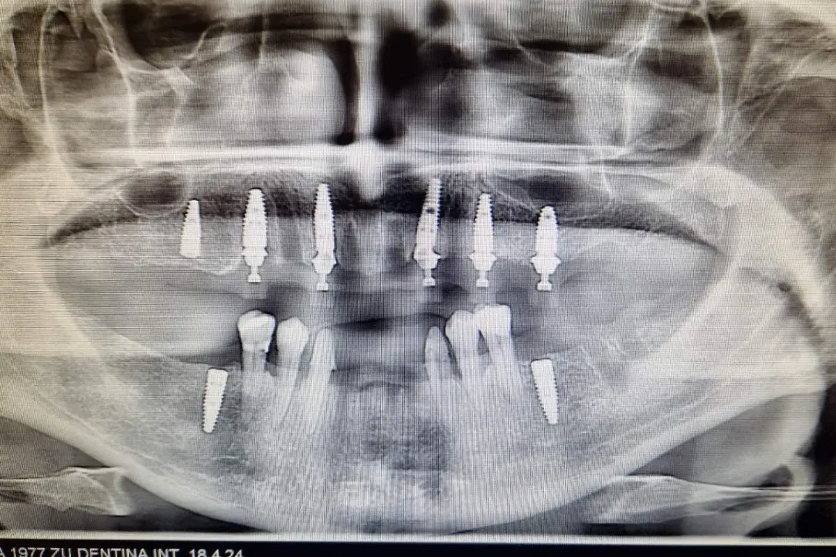 Dentina International 
