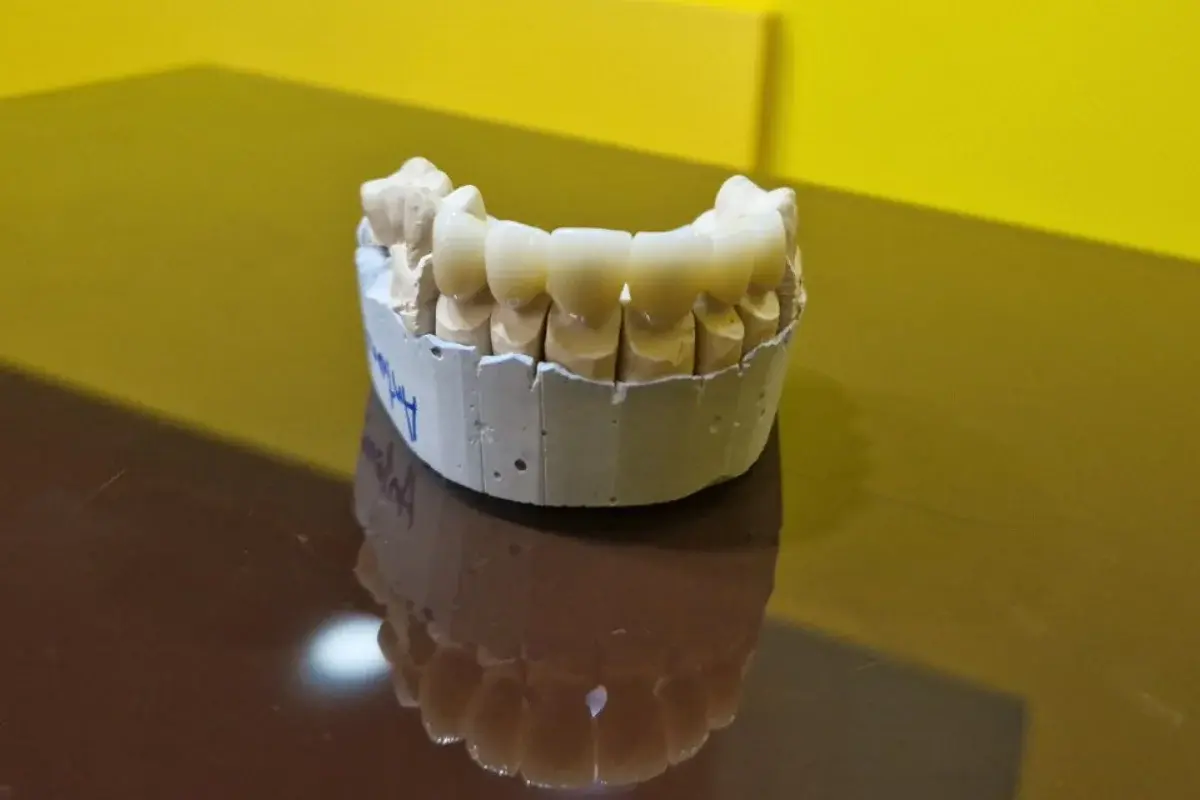 Dentina International 